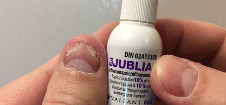 order cheaper jublia online in Ohkay Owingeh, NM